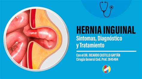 sintomas de una hernia inguinal